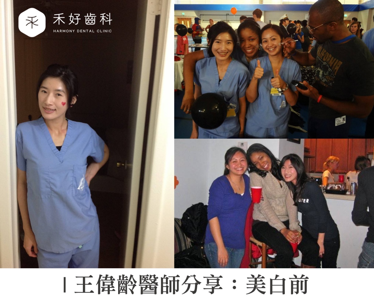 牙齒美白前