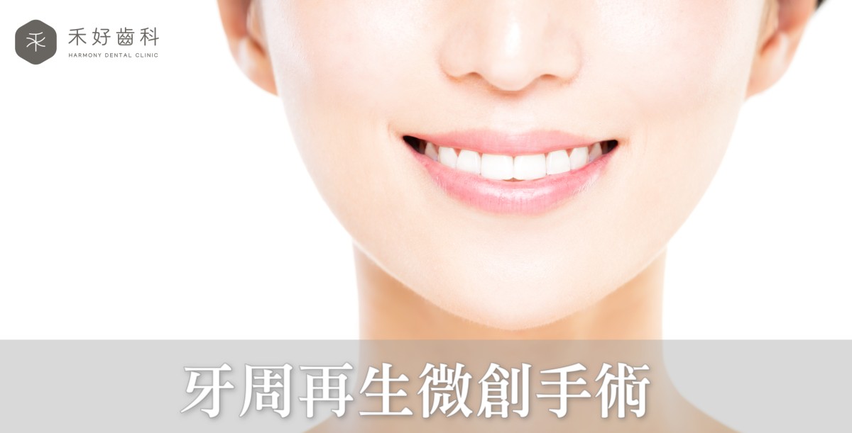 牙周再生微創手術
