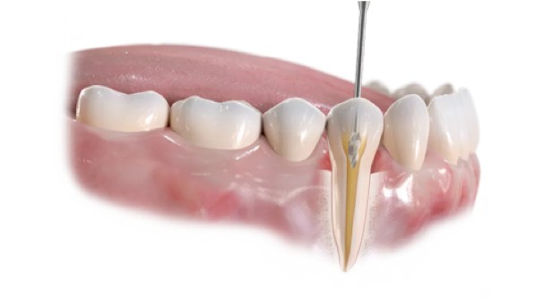https://www.harmonydc.com.tw/wp-content/uploads/2025/07/teeth-03.jpg