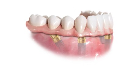 https://www.harmonydc.com.tw/wp-content/uploads/2025/07/teeth-04.jpg