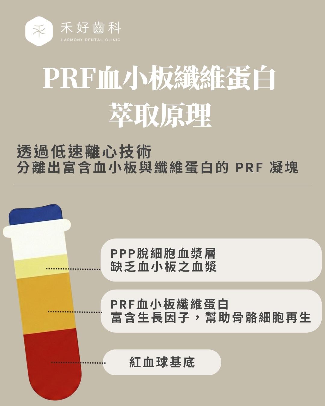PRF血小板纖維蛋白萃取原理